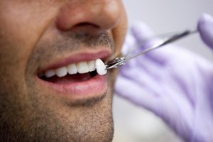 Lente dental em Marataízes